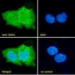 SIAH1 Polyclonal Antibody