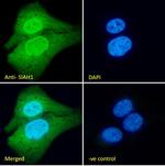 SIAH1 Antibody in Immunocytochemistry (ICC/IF)