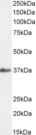 SIAH1 Antibody in Western Blot (WB)