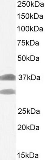SIAH1 Antibody in Western Blot (WB)