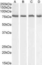 ELMO2 Antibody in Western Blot (WB)