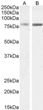 ELMO2 Antibody in Western Blot (WB)