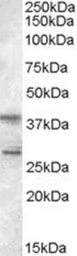 SKAP2 Polyclonal Antibody