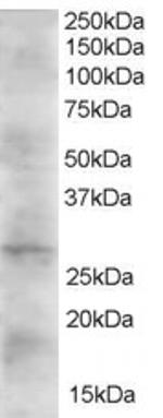 DKK2 Polyclonal Antibody