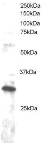 DKK4 Polyclonal Antibody