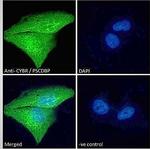 CYTIP Polyclonal Antibody
