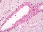 CYTIP Antibody in Immunohistochemistry (Paraffin) (IHC (P))