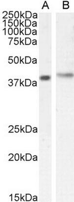 CYTIP Antibody in Western Blot (WB)