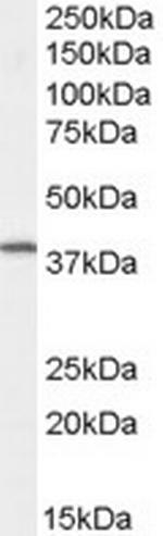 Dysadherin Polyclonal Antibody