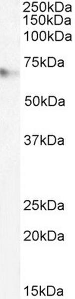 MARK4 Antibody in Western Blot (WB)