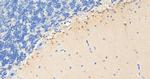 PEBP1 Antibody in Immunohistochemistry (Paraffin) (IHC (P))