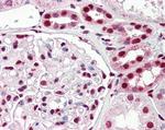 IRF6 Antibody in Immunohistochemistry (Paraffin) (IHC (P))