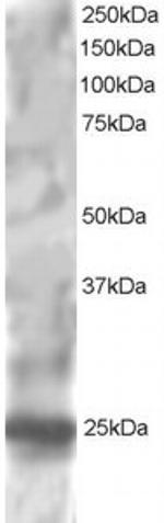 RGS1 Antibody in Western Blot (WB)
