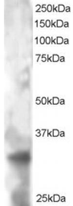 TSPAN32 Polyclonal Antibody