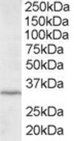 ING2 Polyclonal Antibody