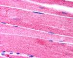 SORBS1 Antibody in Immunohistochemistry (Paraffin) (IHC (P))