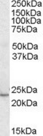 KLF16 Polyclonal Antibody