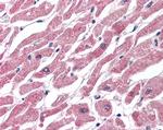 CPT1B Antibody in Immunohistochemistry (Paraffin) (IHC (P))