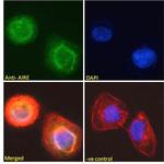 AIRE Antibody in Immunocytochemistry (ICC/IF)