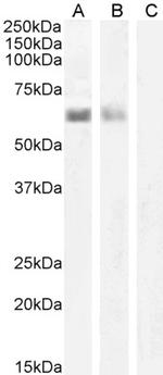 AIRE Antibody in Western Blot (WB)