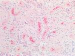 CBR1 Antibody in Immunohistochemistry (Paraffin) (IHC (P))