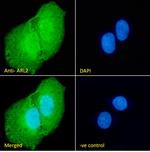 ARL2 Polyclonal Antibody