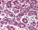 Importin 7 Antibody in Immunohistochemistry (Paraffin) (IHC (P))