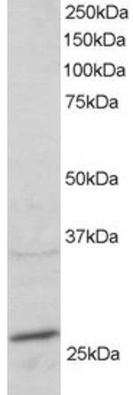 RAB11A Polyclonal Antibody
