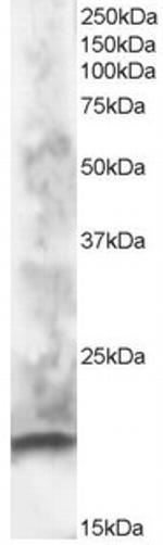CABP1 Polyclonal Antibody