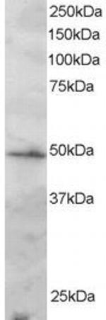 IRF2 Polyclonal Antibody