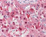 HEC1 Antibody in Immunohistochemistry (Paraffin) (IHC (P))