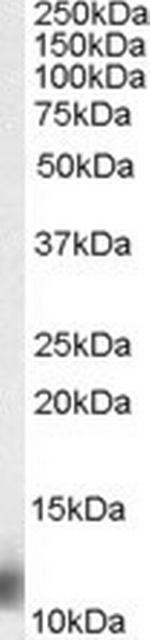 MPS1 Antibody in Western Blot (WB)