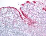 HSPB8 Antibody in Immunohistochemistry (Paraffin) (IHC (P))