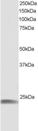 HSPB8 Antibody in Western Blot (WB)