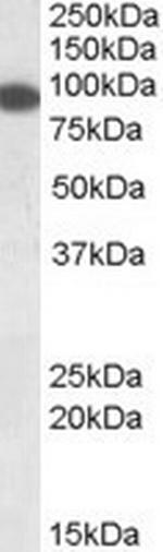 ERC1 Antibody in Western Blot (WB)