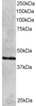 RAD51C Polyclonal Antibody