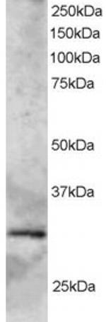 SYF2 Polyclonal Antibody