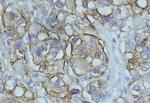 NDRG1 Polyclonal Antibody