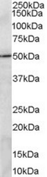 PRDM11 Antibody in Western Blot (WB)