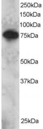 SETMAR Polyclonal Antibody