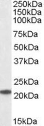 UBE2T Polyclonal Antibody