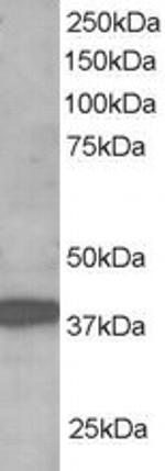 RNF39 Antibody in Western Blot (WB)