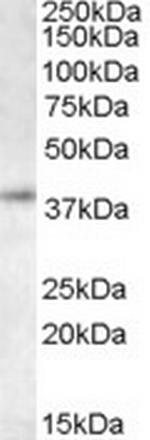RNF2 Polyclonal Antibody