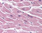 ALS2CR2 Antibody in Immunohistochemistry (Paraffin) (IHC (P))