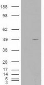 ALS2CR2 Antibody in Western Blot (WB)