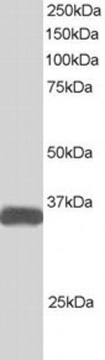ALS2CR2 Antibody in Western Blot (WB)