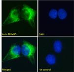 MURF2 Polyclonal Antibody