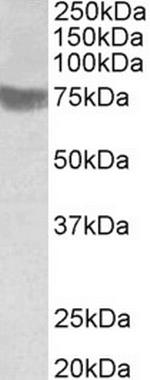 RNF139 Antibody in Western Blot (WB)