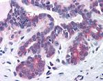 SNX16 Antibody in Immunohistochemistry (Paraffin) (IHC (P))