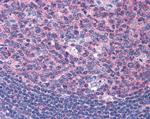 SNX16 Antibody in Immunohistochemistry (Paraffin) (IHC (P))